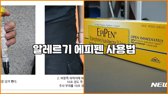 알레르기 에피펜 사용법