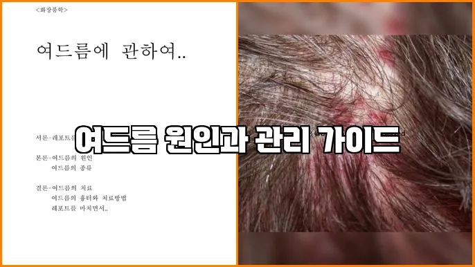 여드름 원인과 관리 가이드